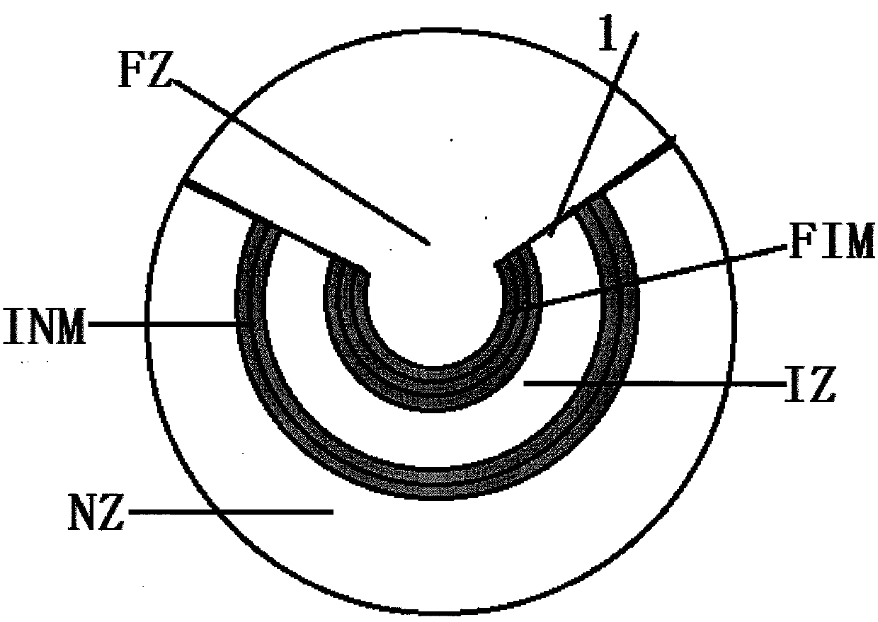 Annular trifocus and bifocus spectacle lens