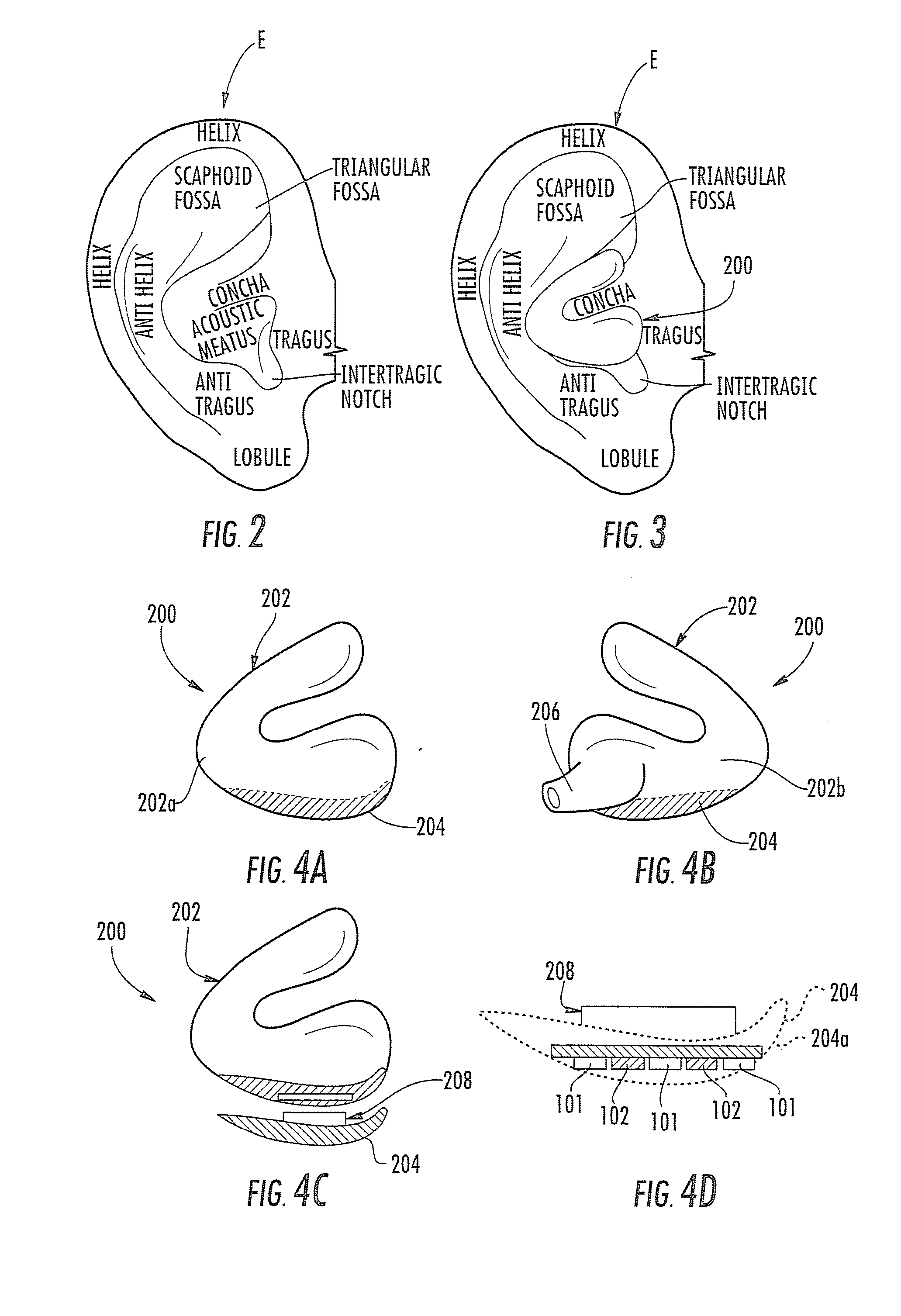 Form-Fitted Monitoring Apparatus for Health and Environmental Monitoring