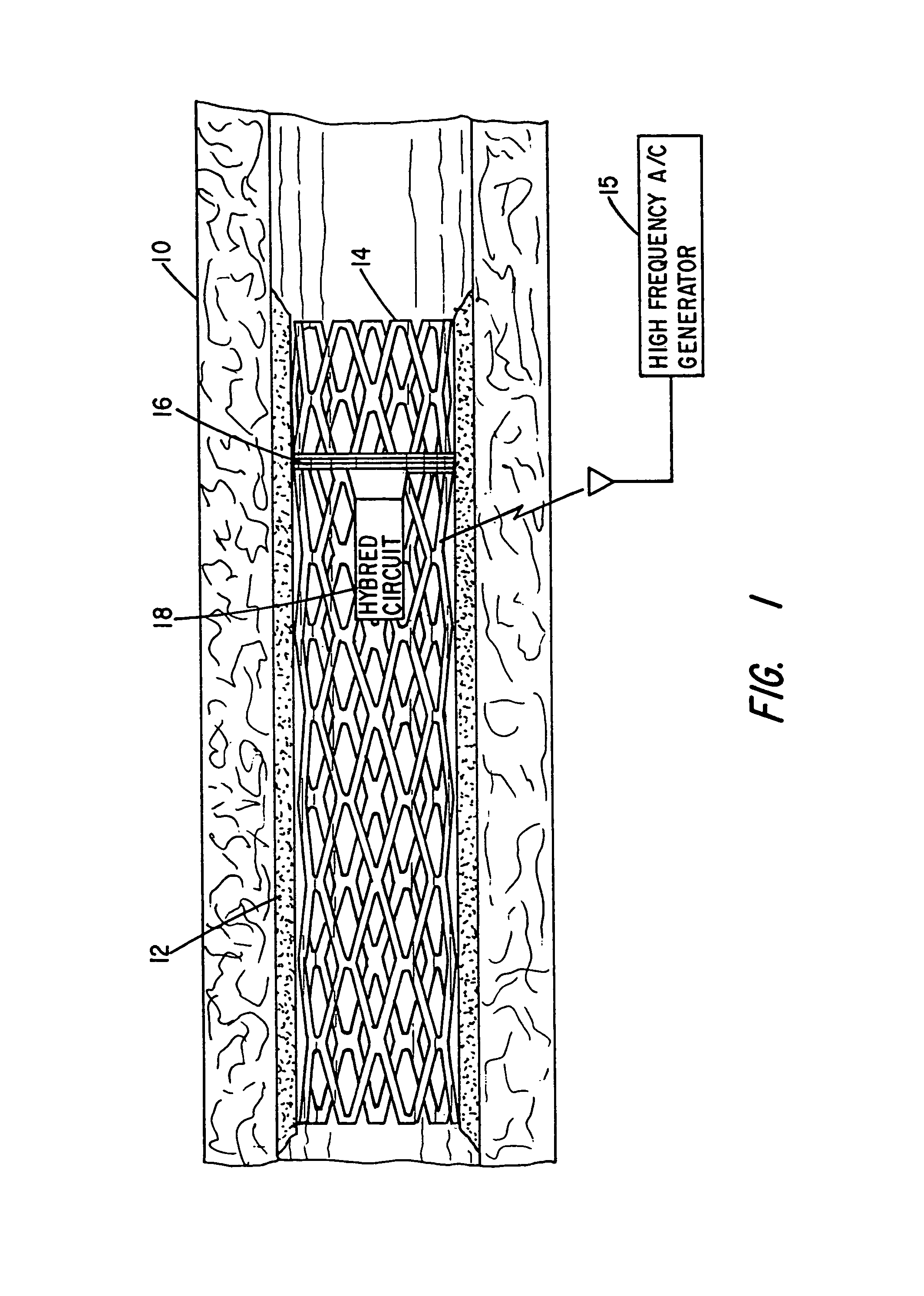 Implantable device for promoting repair of a body lumen