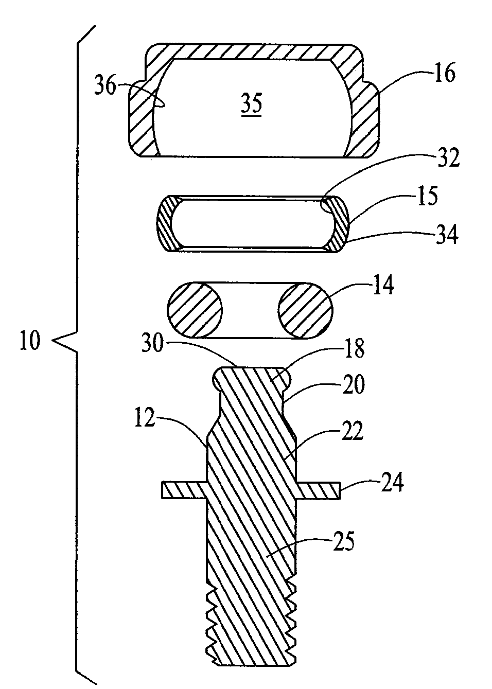 Dental attachment assembly and method
