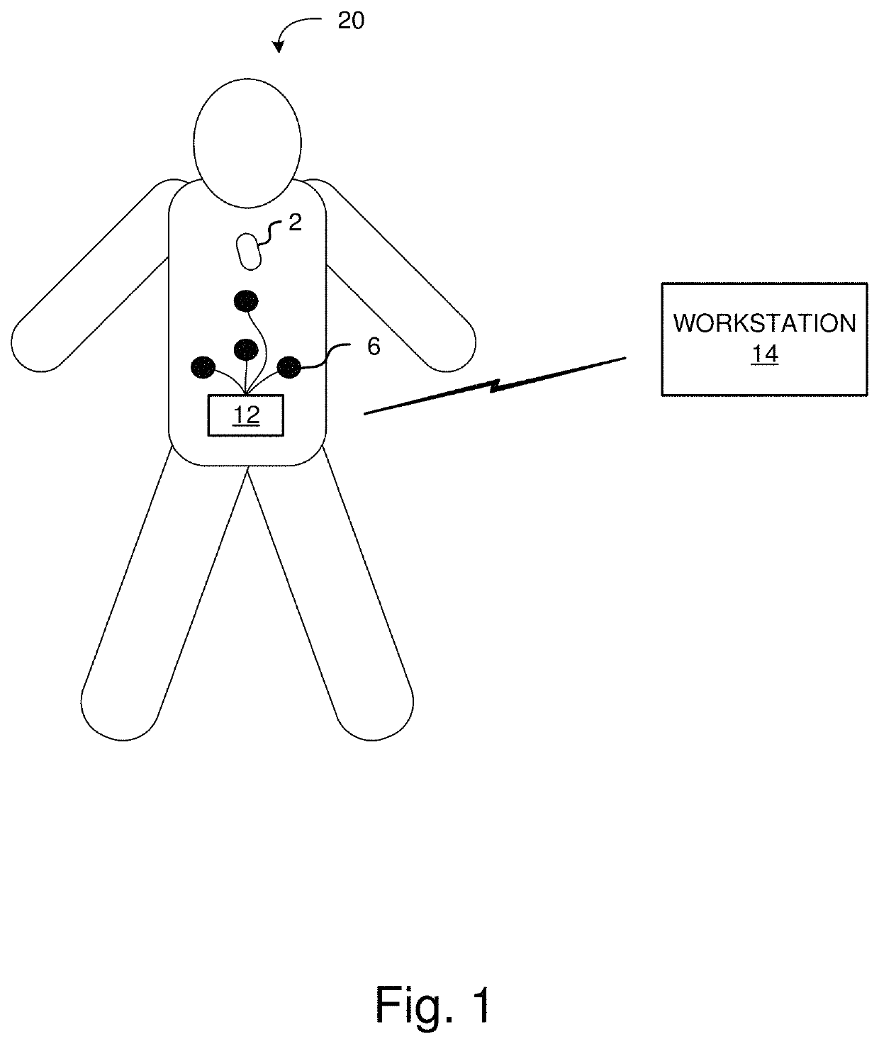 Implantable communication system starter system and methods