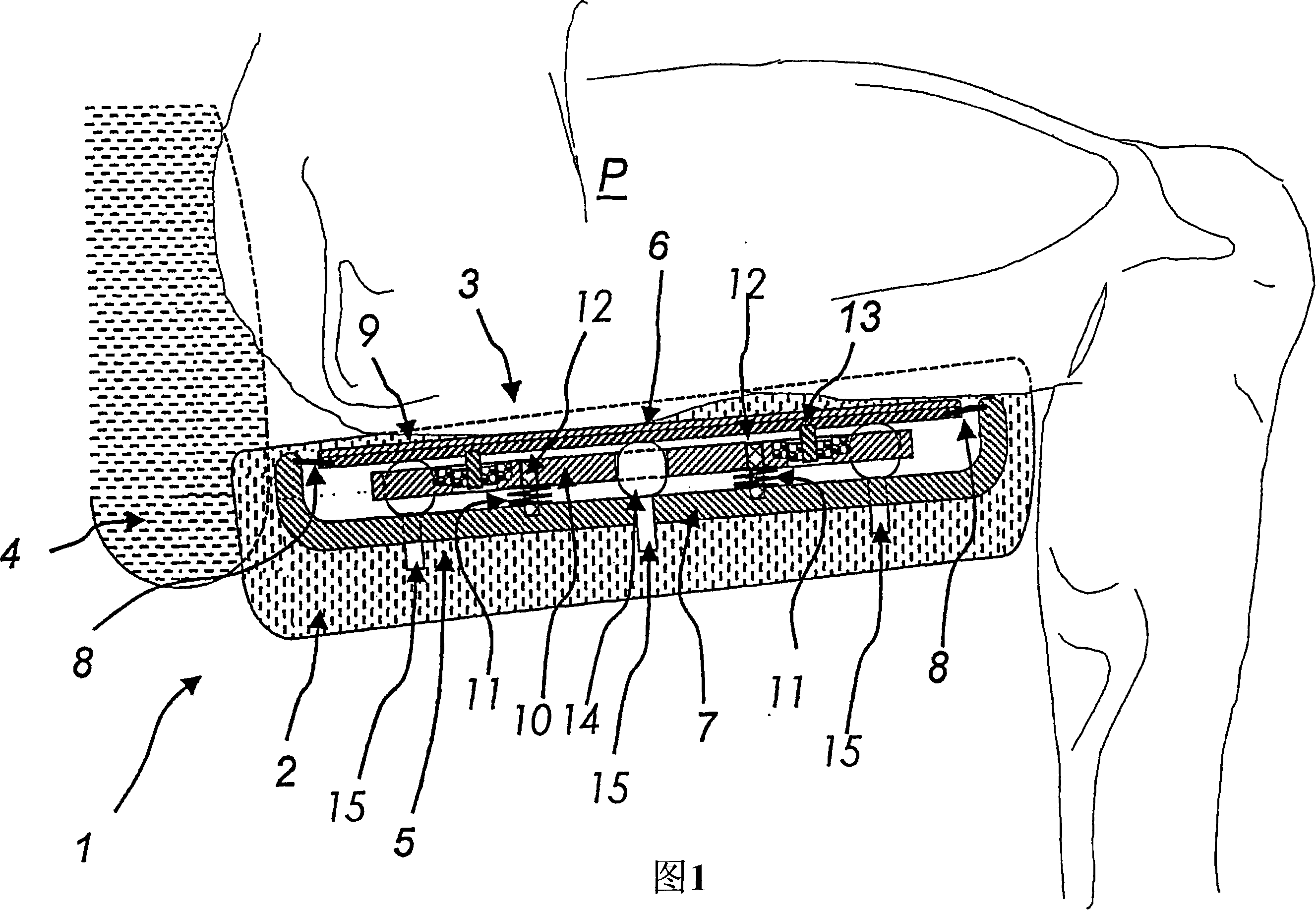 Seating or reclining furniture comprising a vibrating device for improving blood circulation