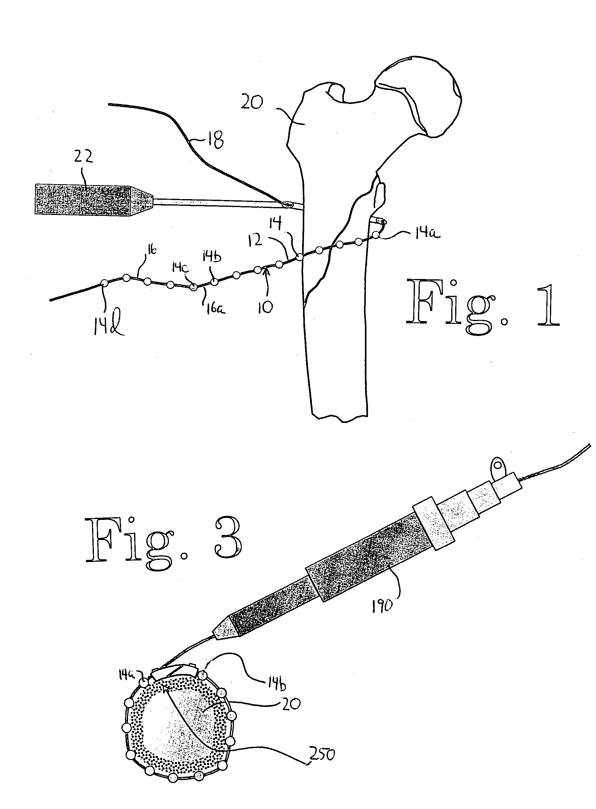 Surgical instrument, and related methods