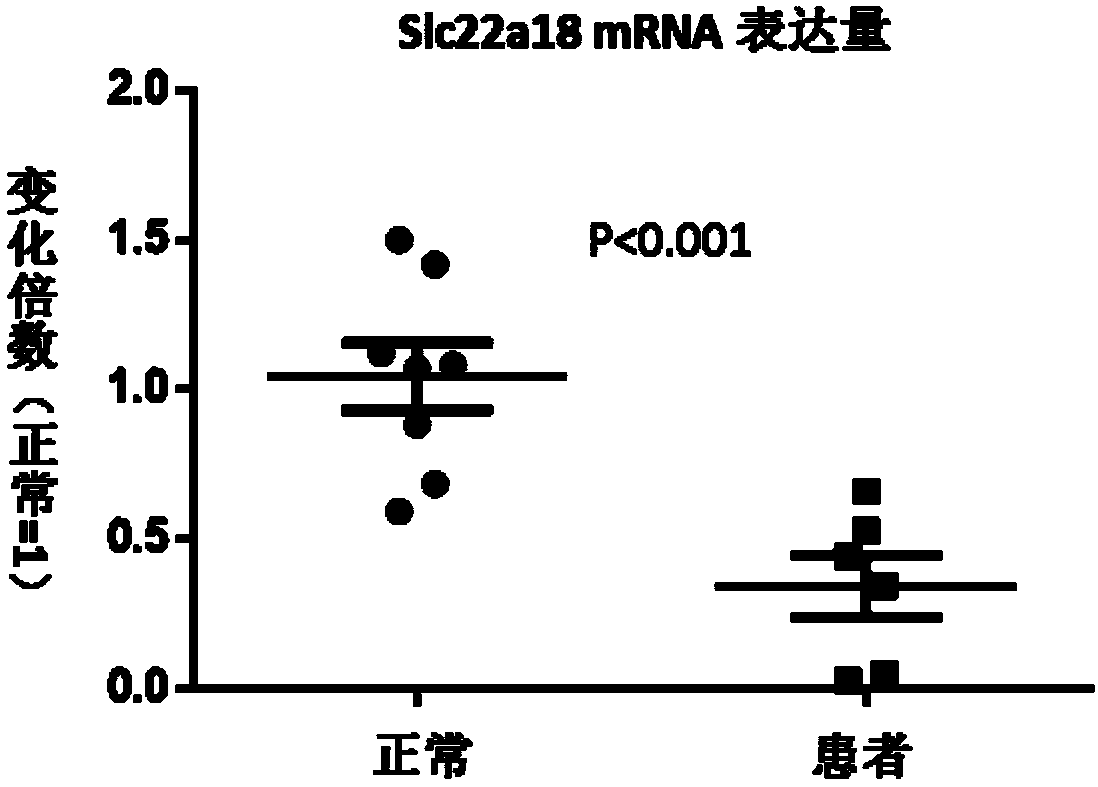Gene SLC22A18 capable of influencing fat metabolism and growth and development of children