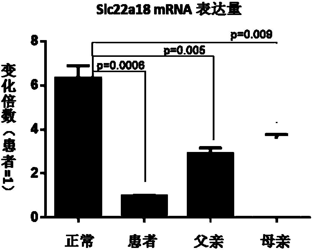 Gene SLC22A18 capable of influencing fat metabolism and growth and development of children