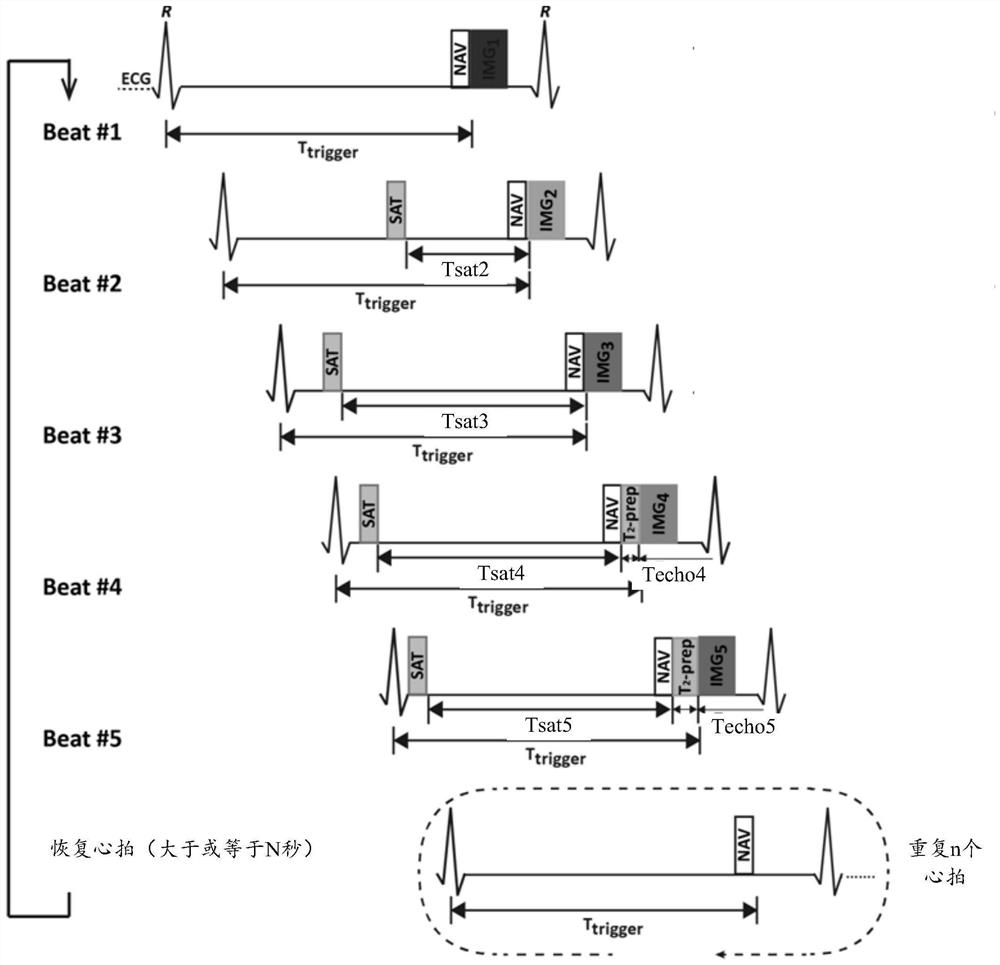 Quantitative myocardial magnetic resonance imaging method, equipment and storage medium