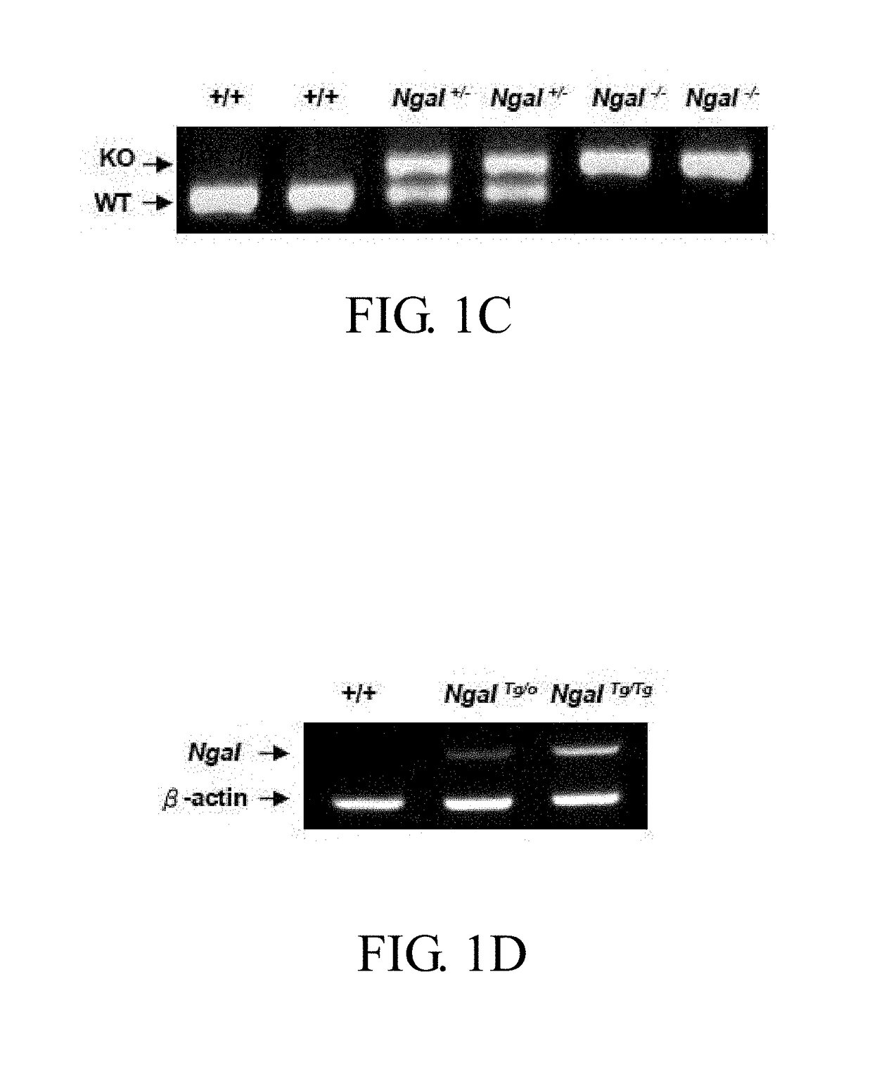 Method of treating or preventing polycystic kidney disease and pkd animal model with exogenous neutrophil gelatinase-associated lipocalin
