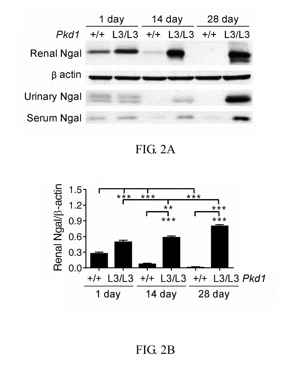 Method of treating or preventing polycystic kidney disease and pkd animal model with exogenous neutrophil gelatinase-associated lipocalin