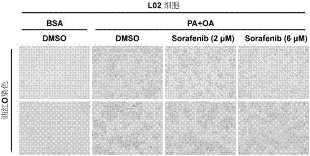 Application of sorafenib to preparing medicine for preventing, alleviating and/or treating fatty liver and related diseases