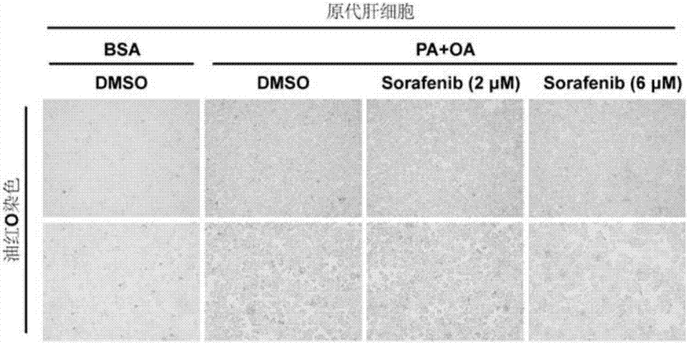 Application of sorafenib to preparing medicine for preventing, alleviating and/or treating fatty liver and related diseases