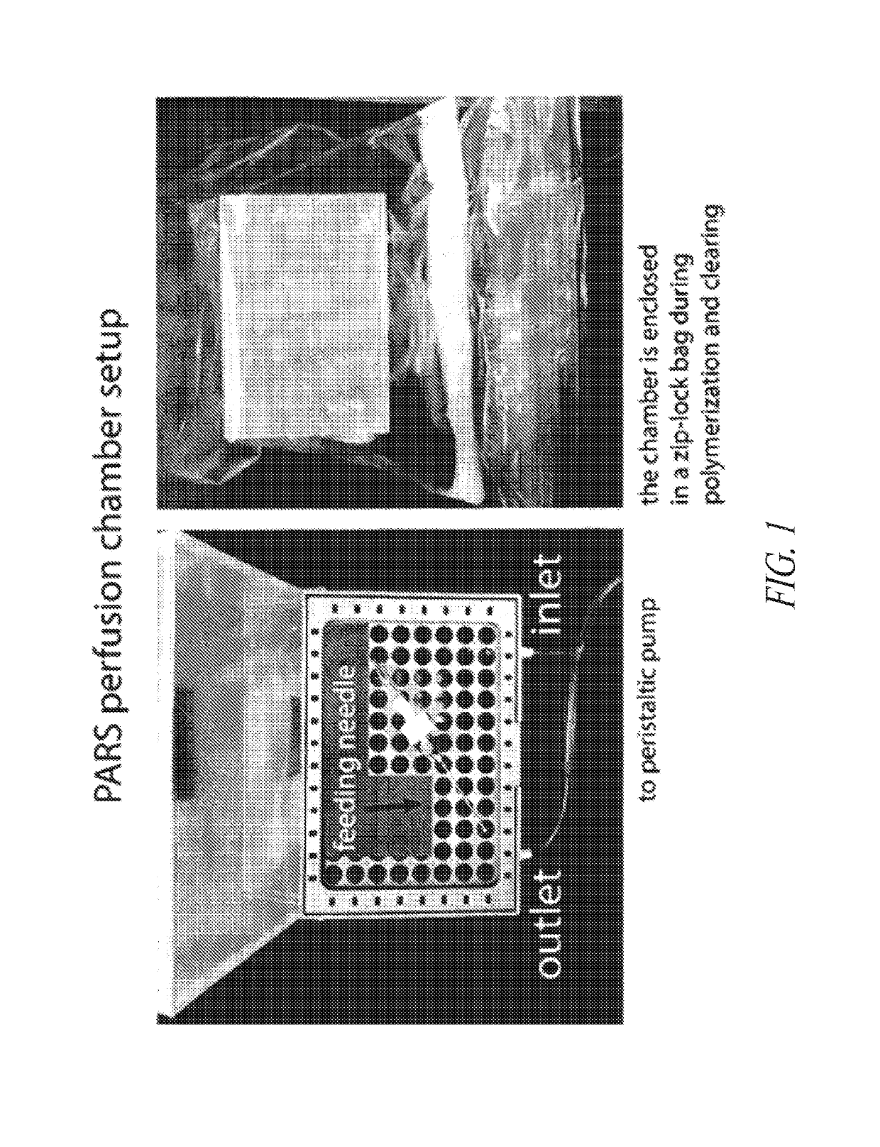 Methods for preparing and analyzing tumor tissue samples for detection and monitoring of cancers
