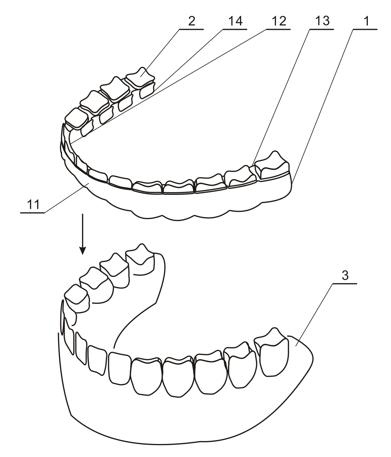 Tooth socket for protecting teeth