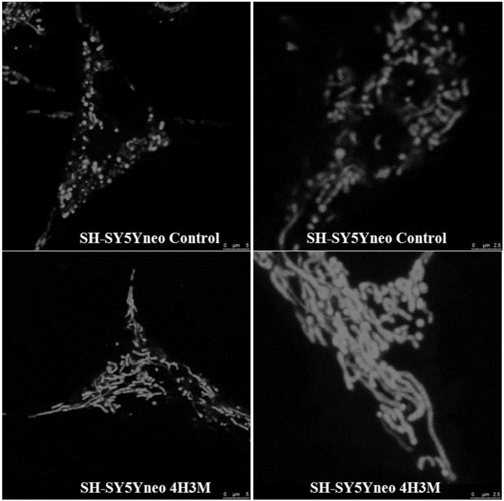 Application of coniferyl aldehyde or coniferyl aldehyde and vanadium compound composite for preventing and treating neurodegenerative disease