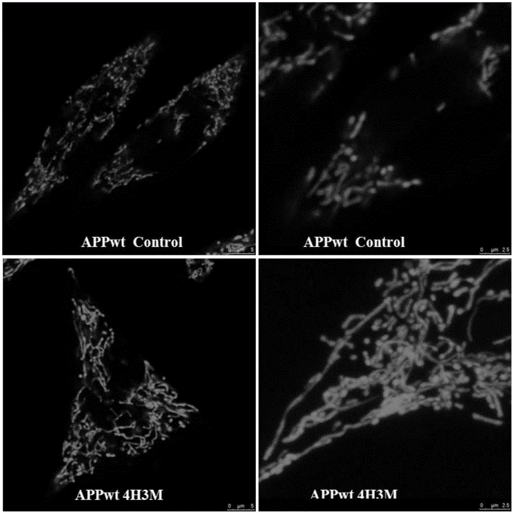 Application of coniferyl aldehyde or coniferyl aldehyde and vanadium compound composite for preventing and treating neurodegenerative disease