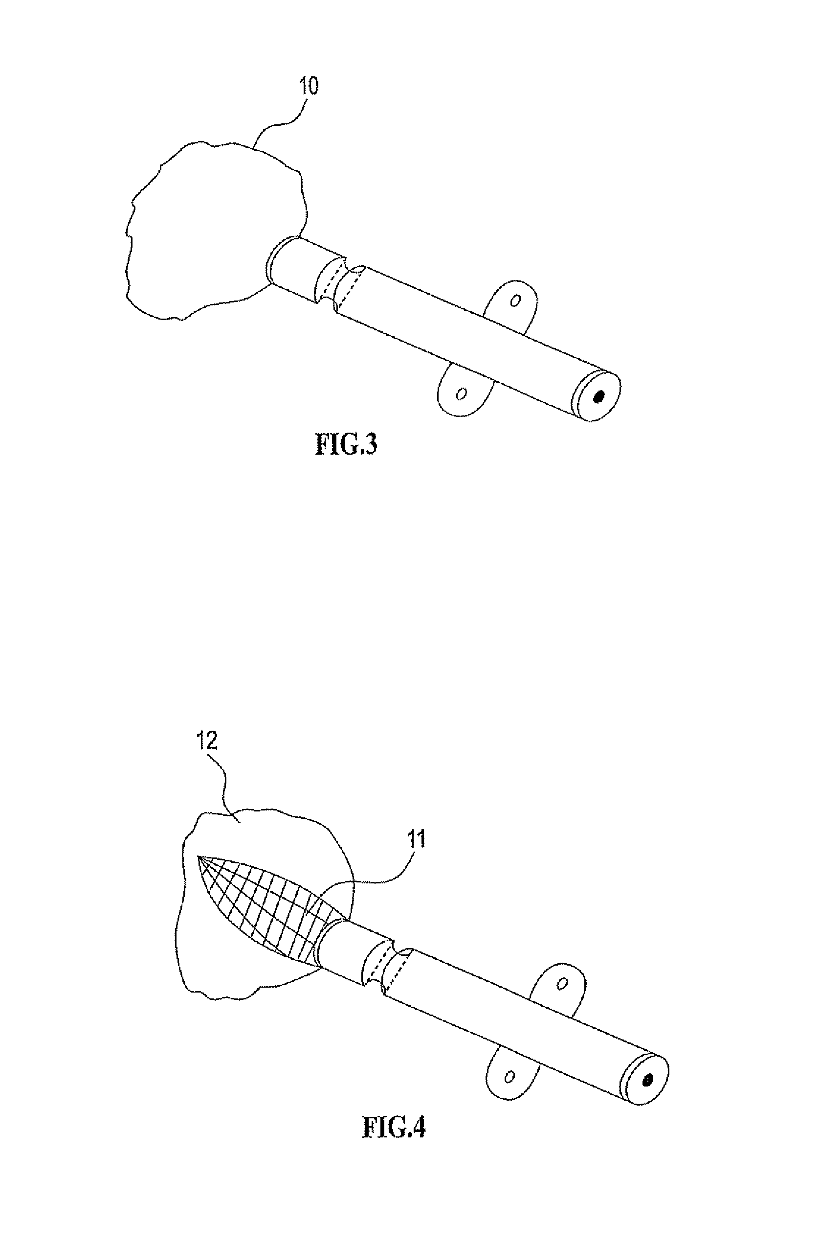 Method for tissue expansion and regeneration using bioresorbable inflatable devices
