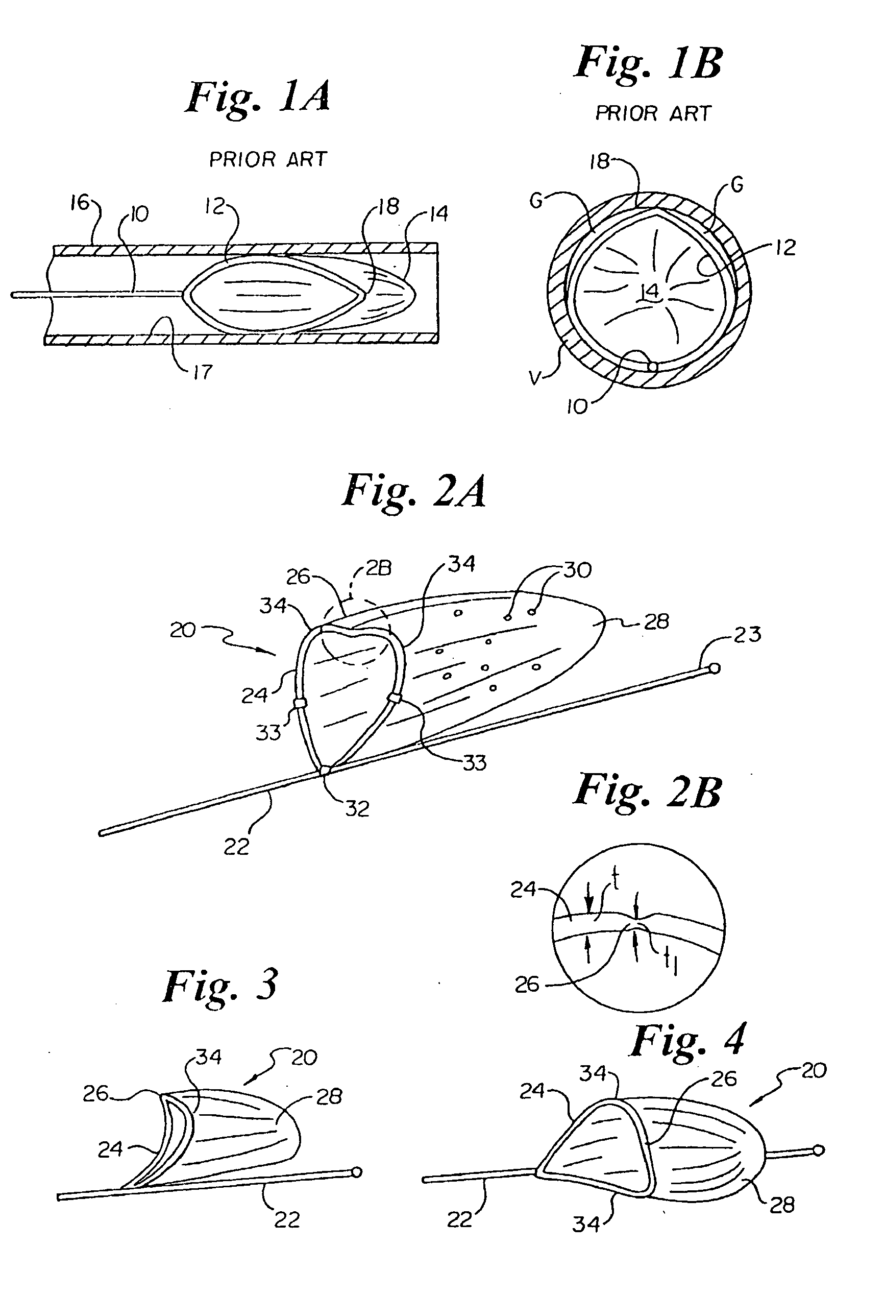 Vascular filter having articulation region and methods of use in the ascending aorta
