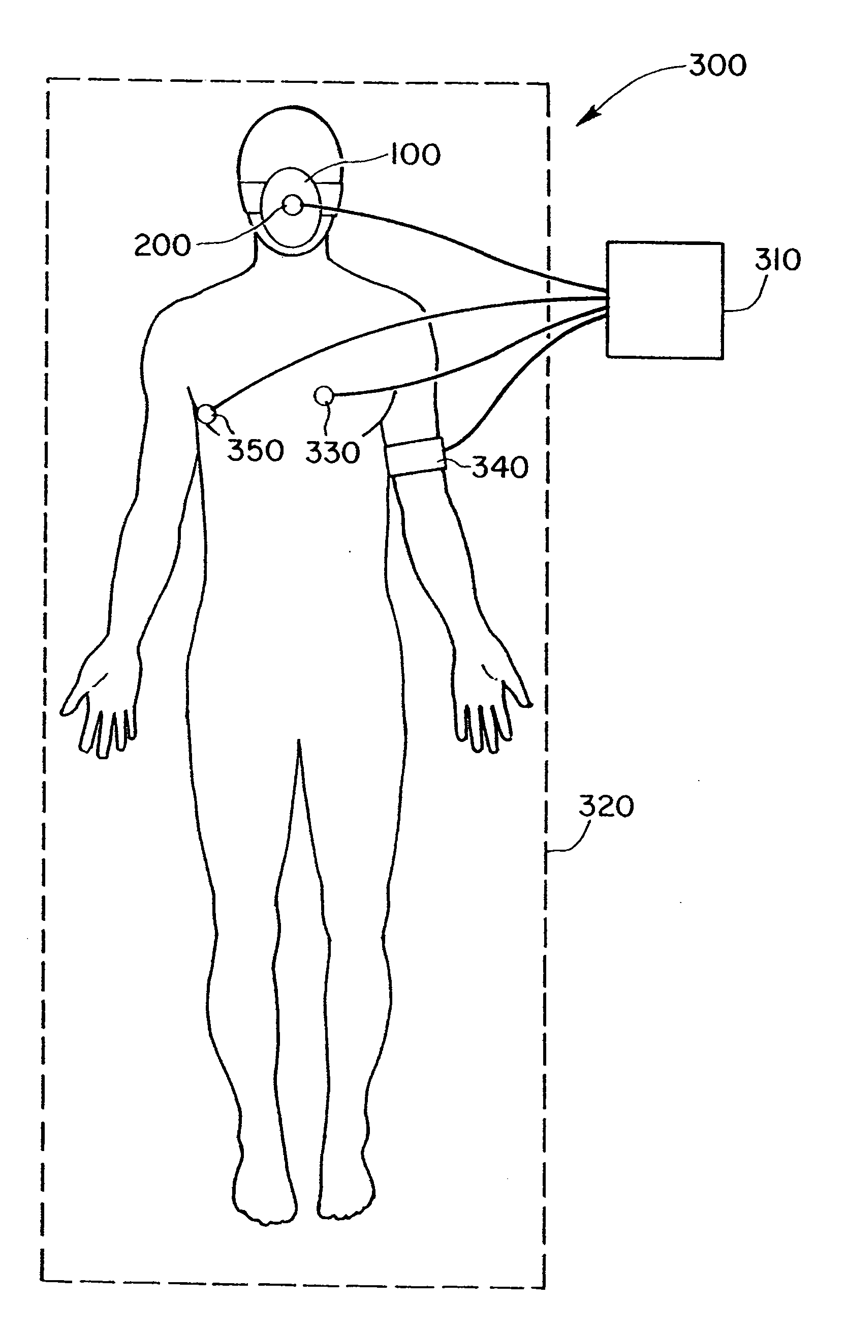 System for sensing, diagnosing and treating physiological conditions and methods