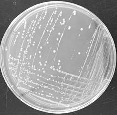 A strain of Lactobacillus paracasei and its application