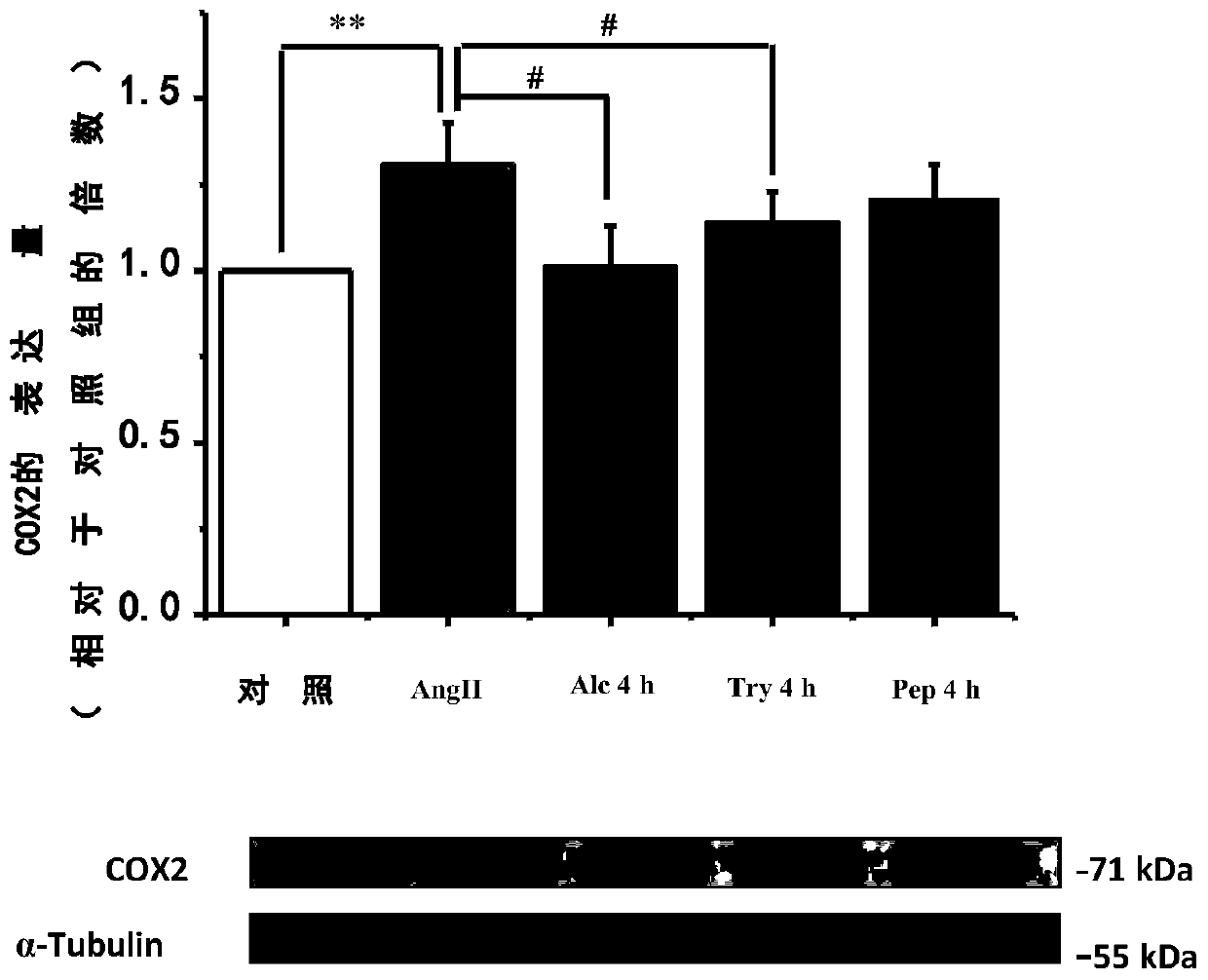 Application of broad bean protein peptide in preparing drugs for treating inflammation and drug for treating inflammation