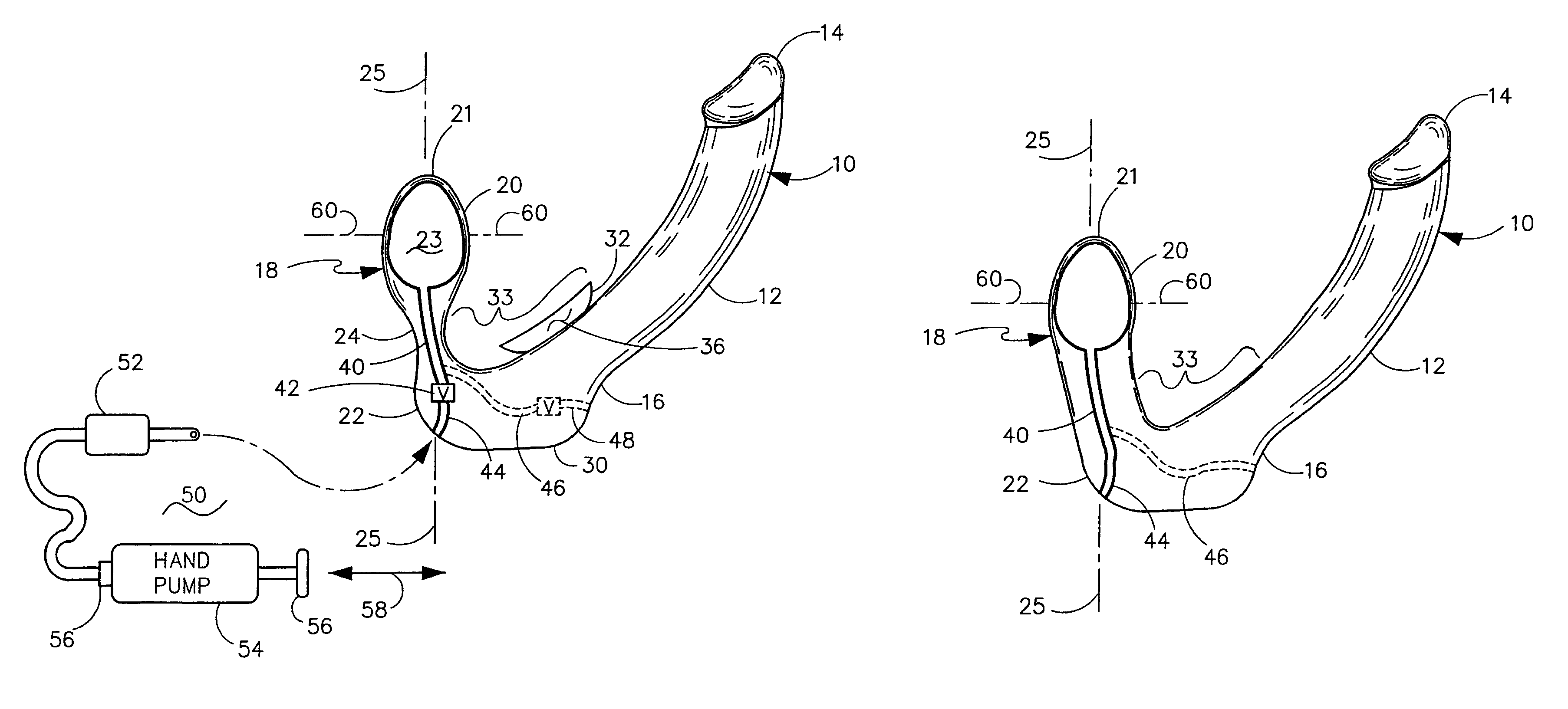 Erogenic stimulator with expandable bulbous end