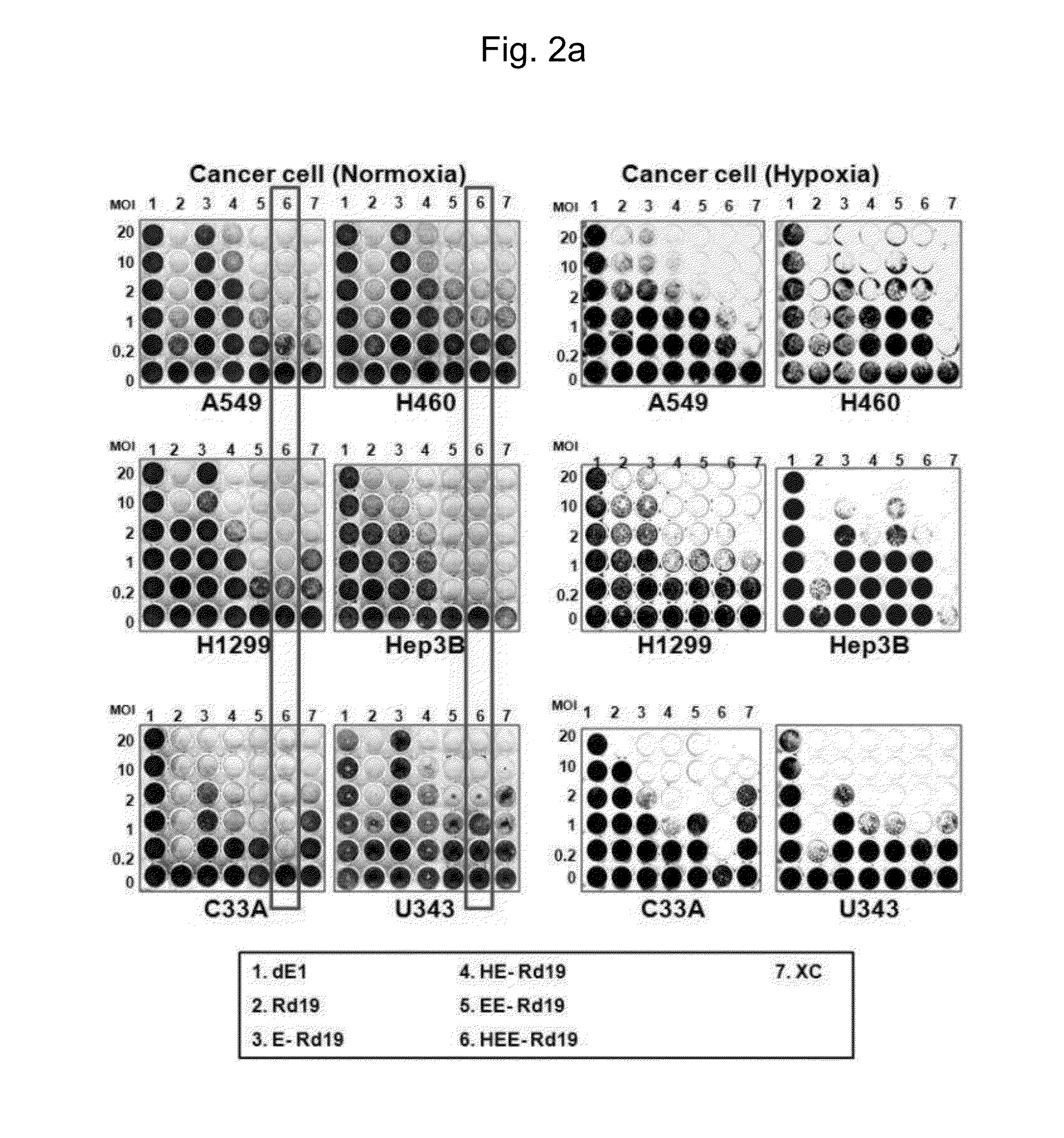 Gene delivery system having enhanced tumor-specific expression, and recombinant gene expression regulating sequence