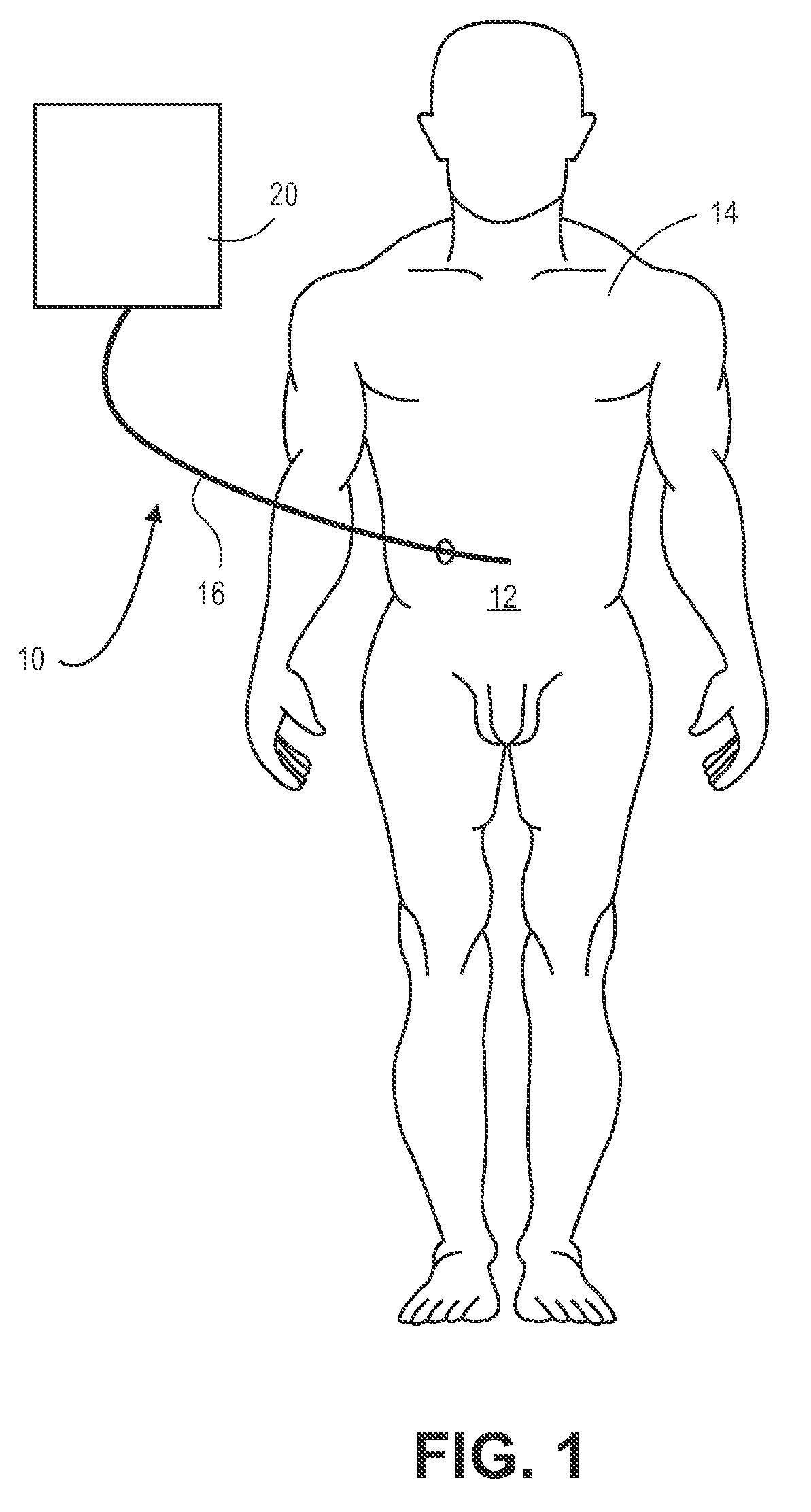 Hypothermia devices and methods