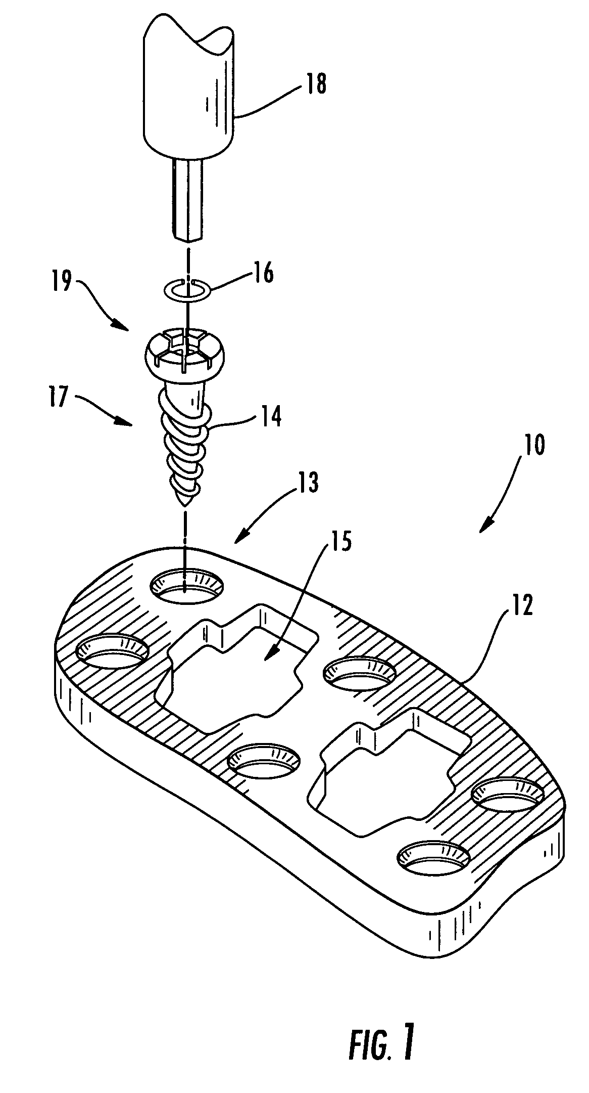 Cervical plate locking mechanism and associated surgical method