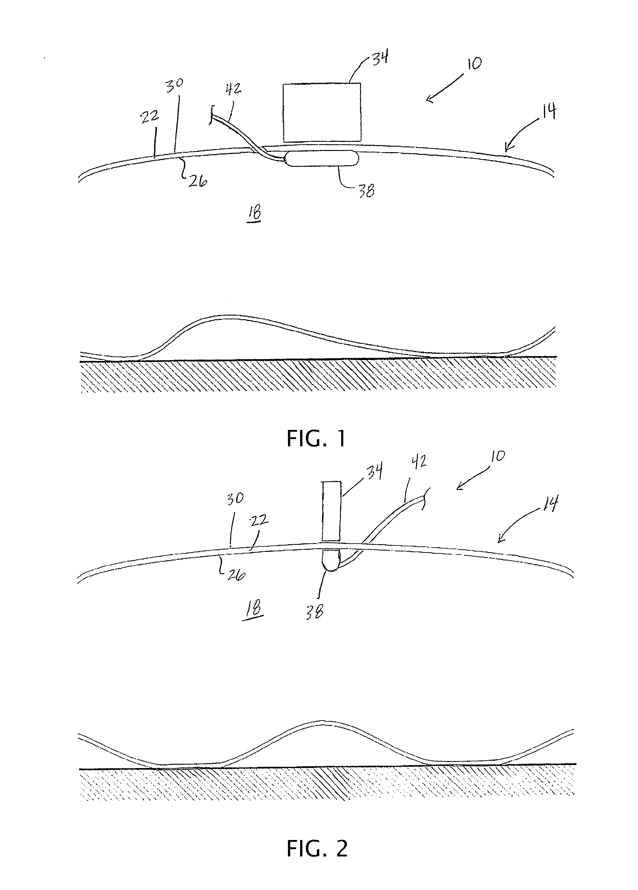 Medical Devices, Apparatuses, Systems, and Methods for Magnetic Transmural and/or Transdermal Activation of Medical Tools