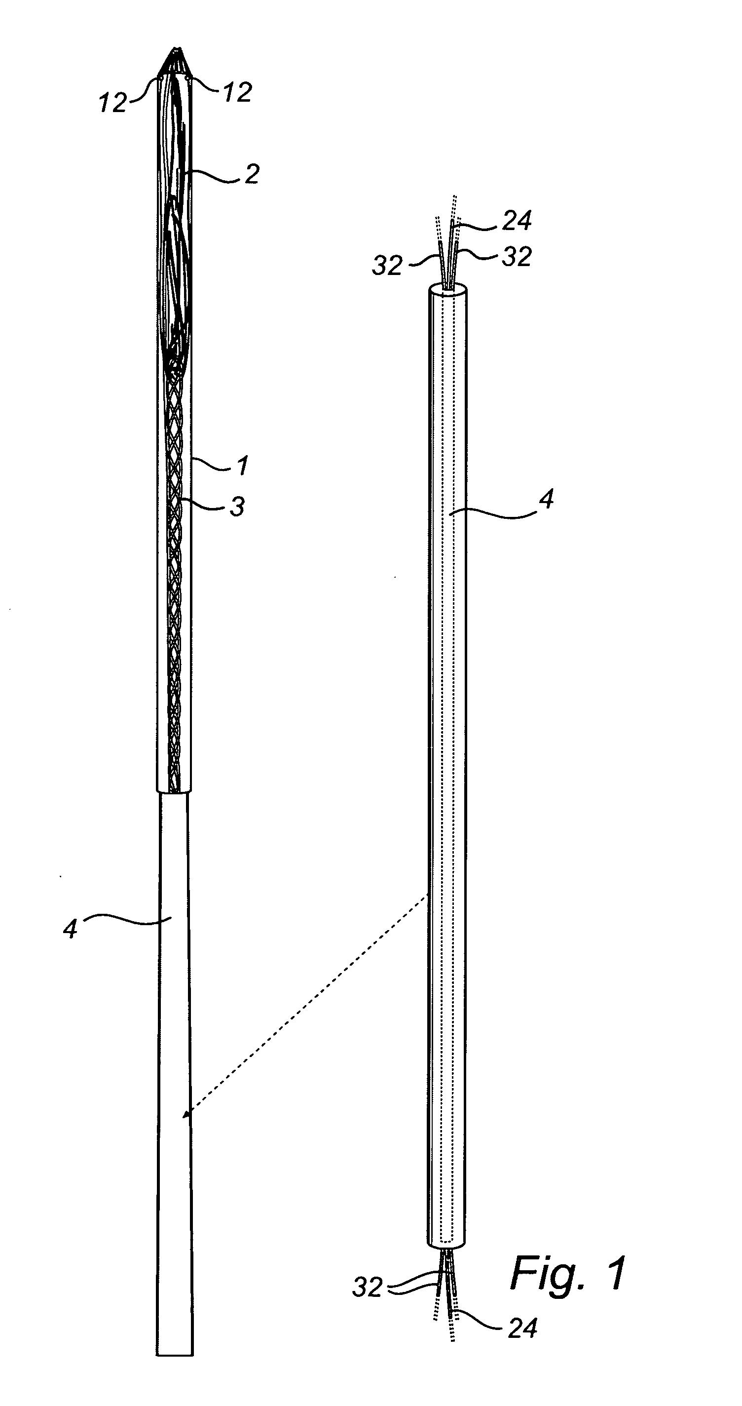 Device and method for treating ruptured aneurysms