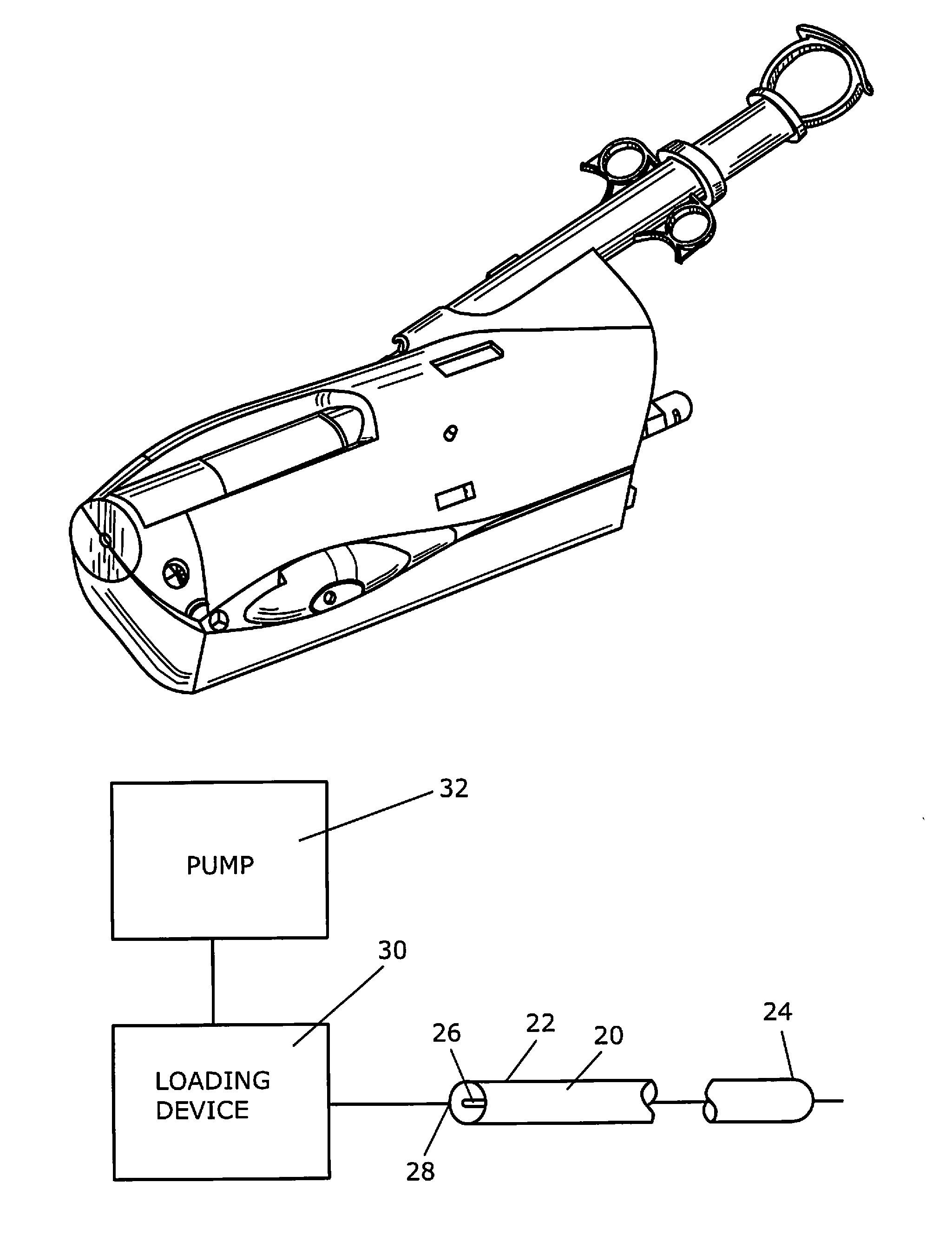 Apparatus and method for radiation treatment of a desired area in the renal vascular system of a patient