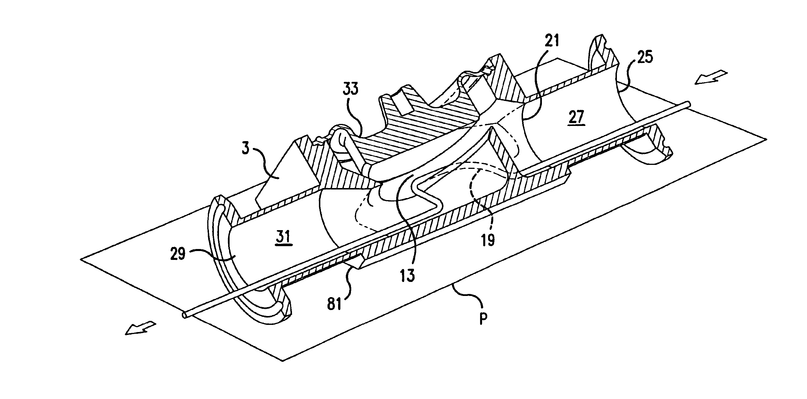 Circumferential sealing diaphragm valve