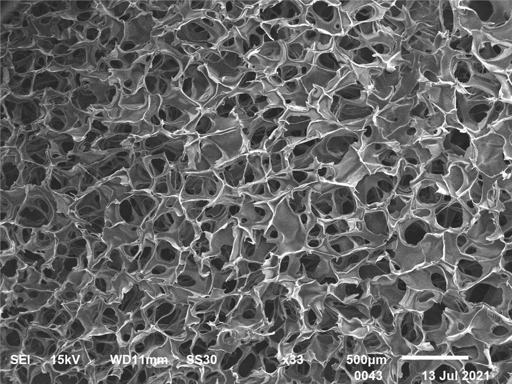 Gradient degradation medical sponge and preparation method thereof