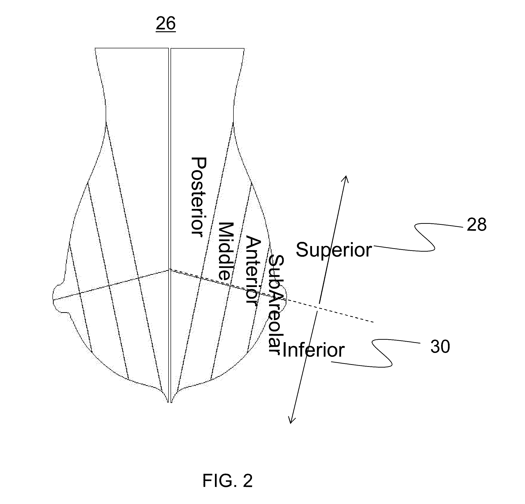 Systems and methods for measurement of objects of interest in medical images