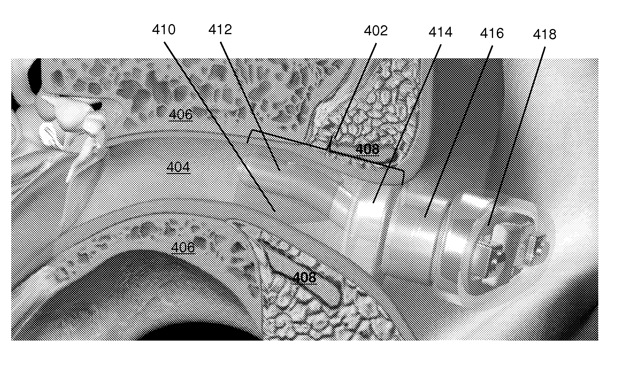 Method and Device for Acoustic Sealing