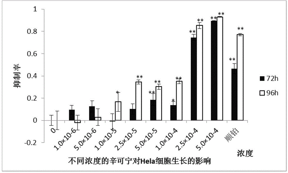 Use of cinchonine in preparation of anti-tumor drugs