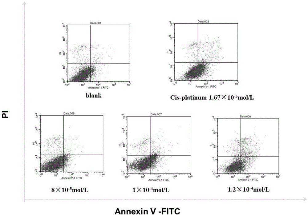 Use of cinchonine in preparation of anti-tumor drugs