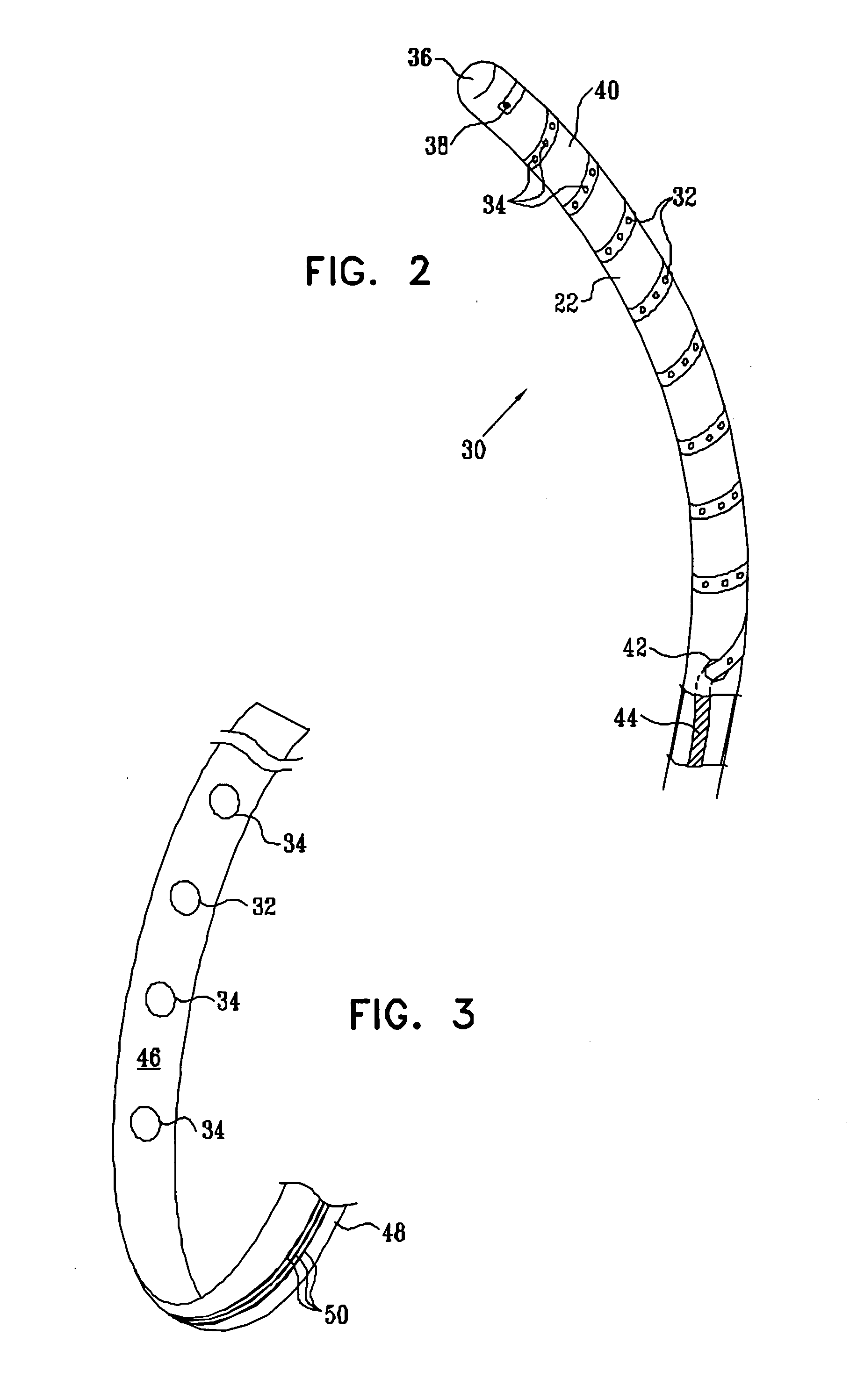 Catheter with electrode strip