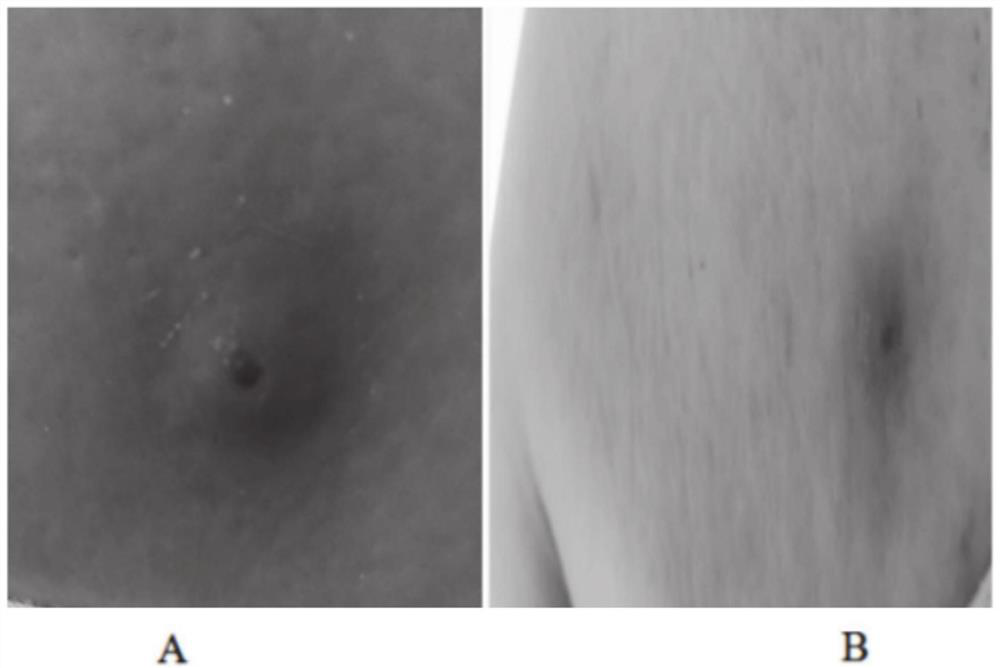 Aromatic plant composition for red, swollen, itching and pain of skin and preparation method of aromatic plant composition