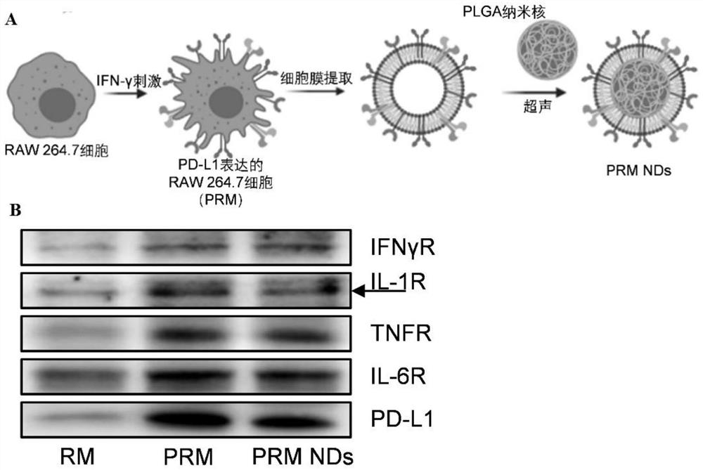 Cell membrane coated nano bait for removing proinflammatory factors and inhibiting T cell activation as well as preparation method and application of cell membrane coated nano bait