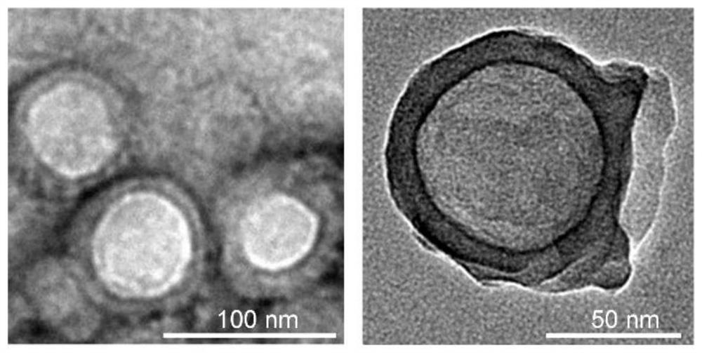 Cell membrane coated nano bait for removing proinflammatory factors and inhibiting T cell activation as well as preparation method and application of cell membrane coated nano bait