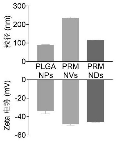 Cell membrane coated nano bait for removing proinflammatory factors and inhibiting T cell activation as well as preparation method and application of cell membrane coated nano bait