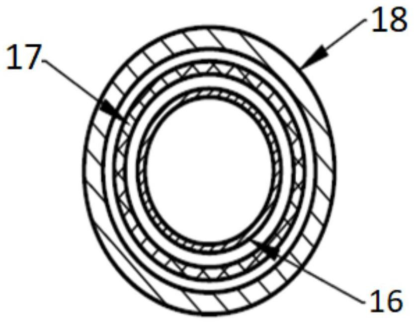 Intravascular stent system and preparation method thereof