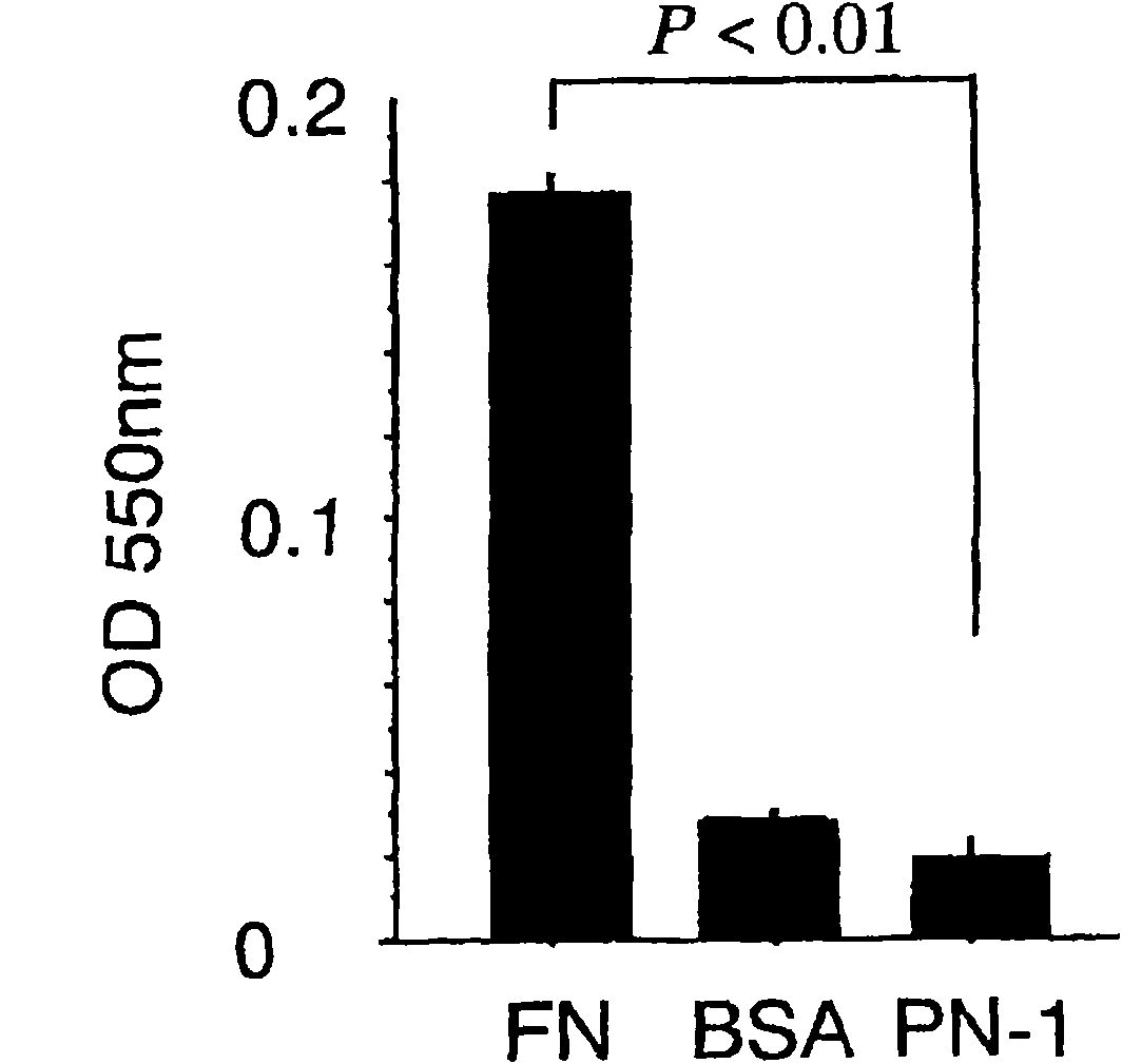 Cancer remedy containing antibody against peptide encoded by exon-17 of periostin
