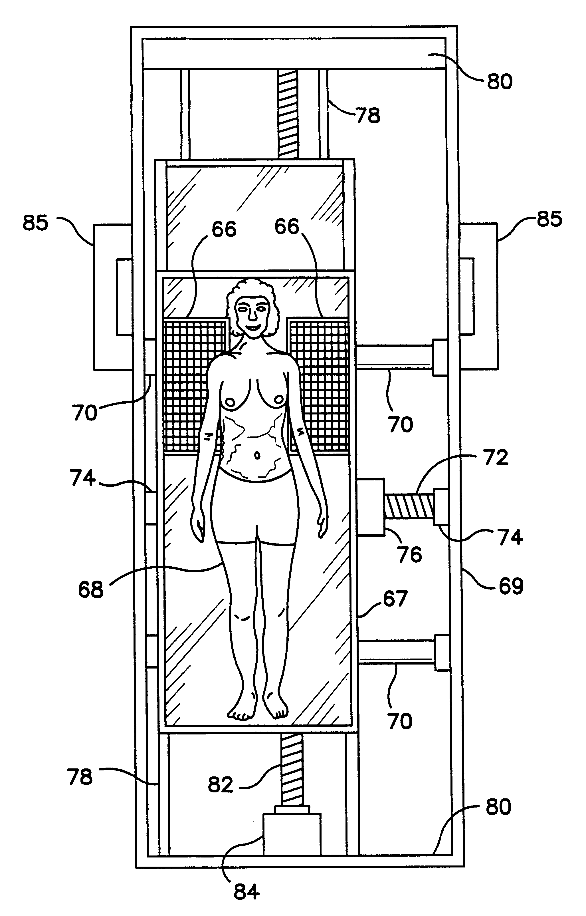 Method and apparatus for detecting very small breast anomalies