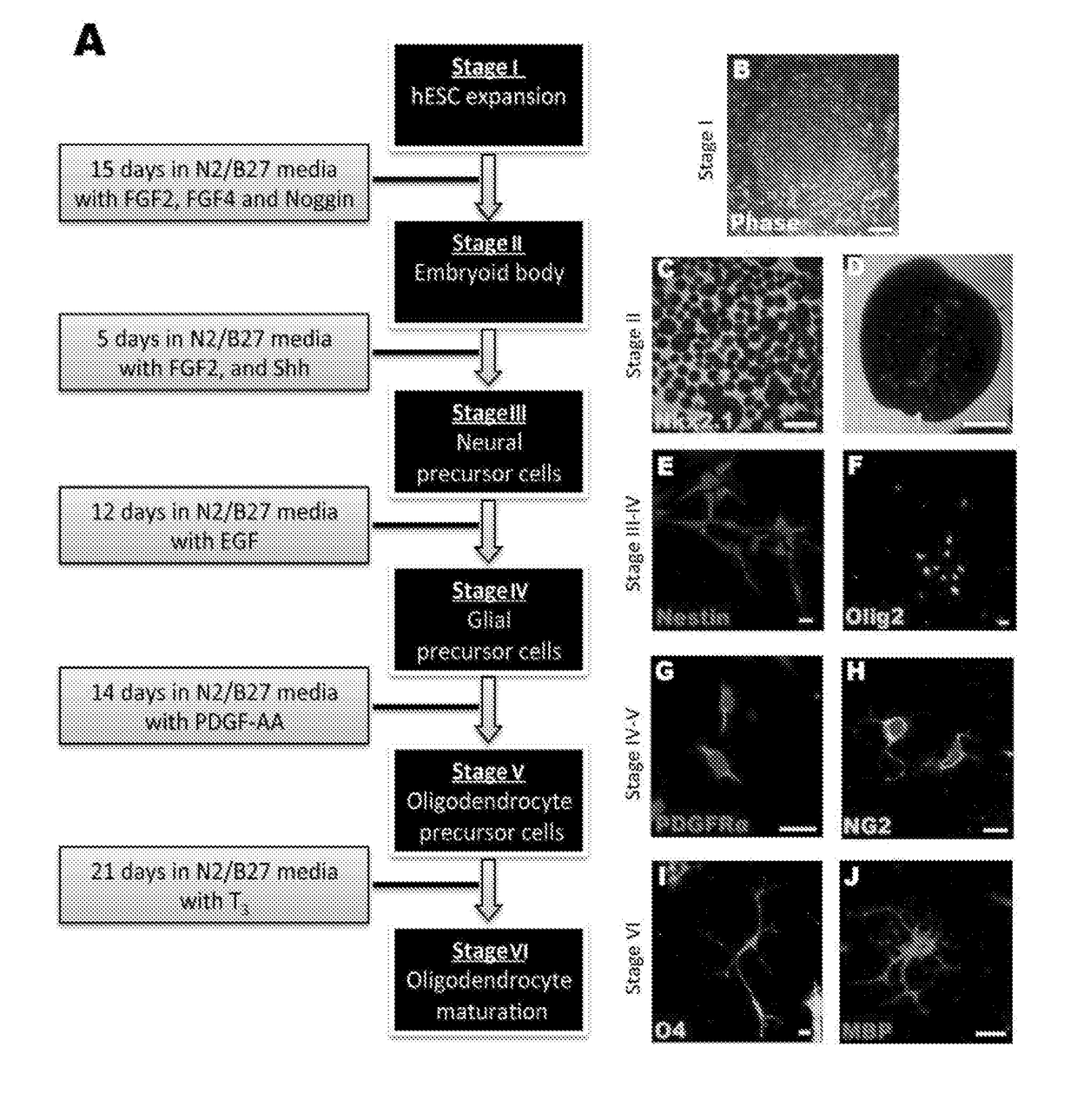 Improvements in Oligodendroglial Cell Culturing Methods and in Methods for Treating Neurodegenerative Disorders by Using Thyroid Hormones or Analogues