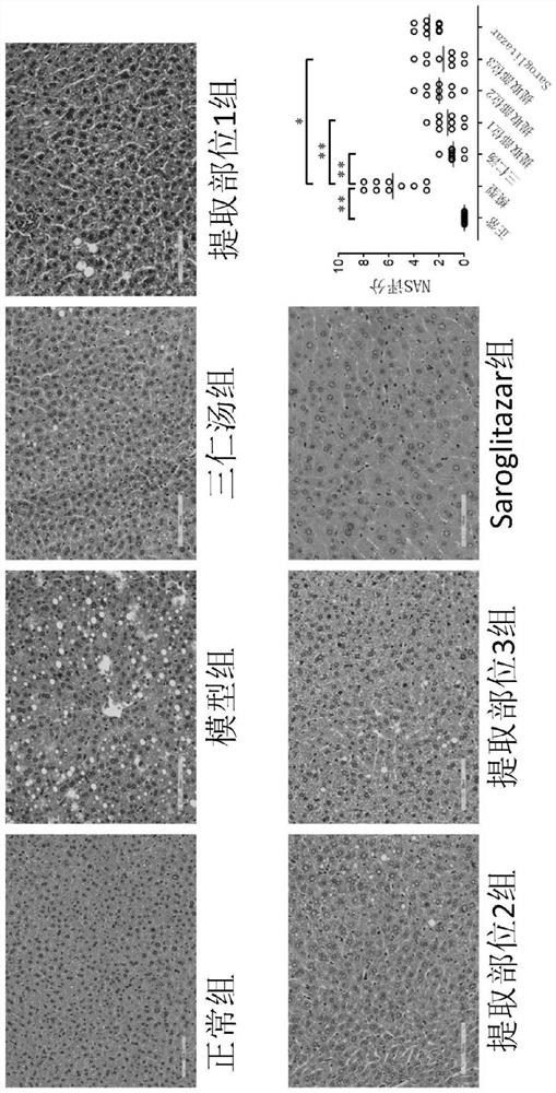 Application of three-kernel decoction to preparation of medicine for treating fatty liver disease