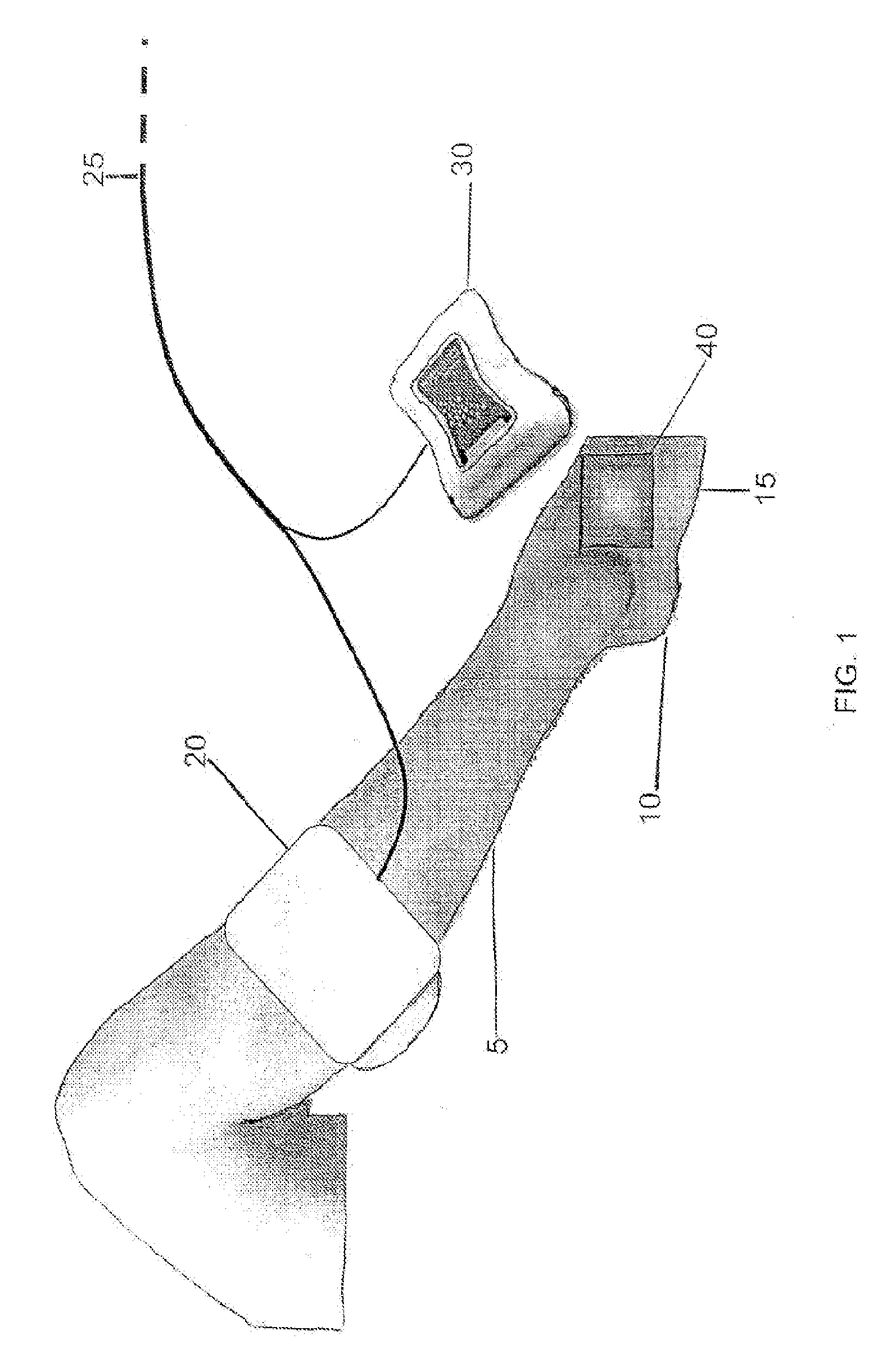 Method of treating a severe diabetic ulcer