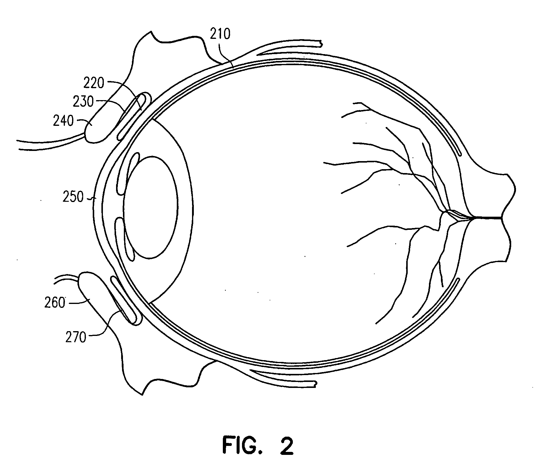 Adhesive bioerodible ocular drug delivery system