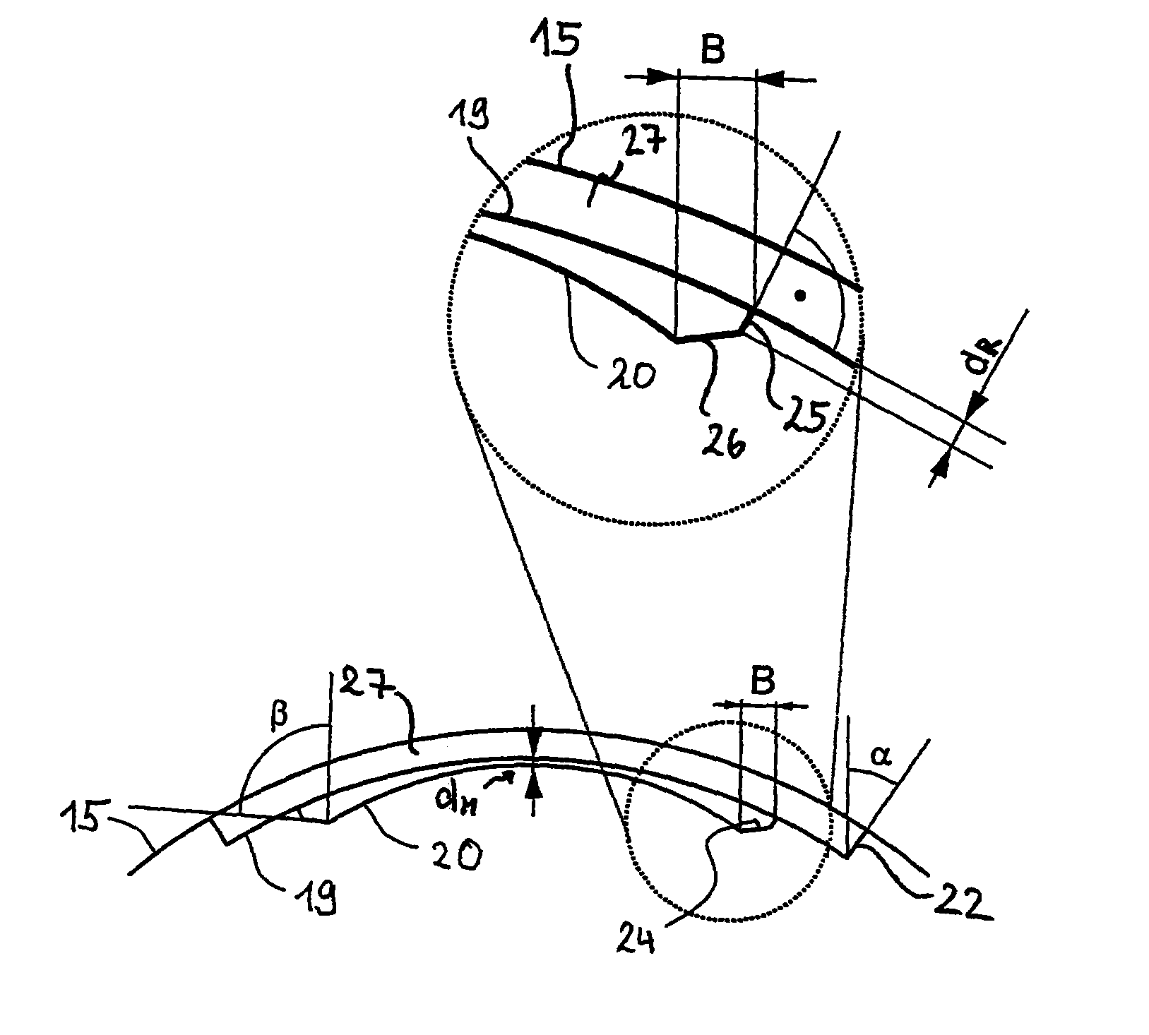 Treatment device for surgically correcting ametropia of an eye and method for creating control data therefore