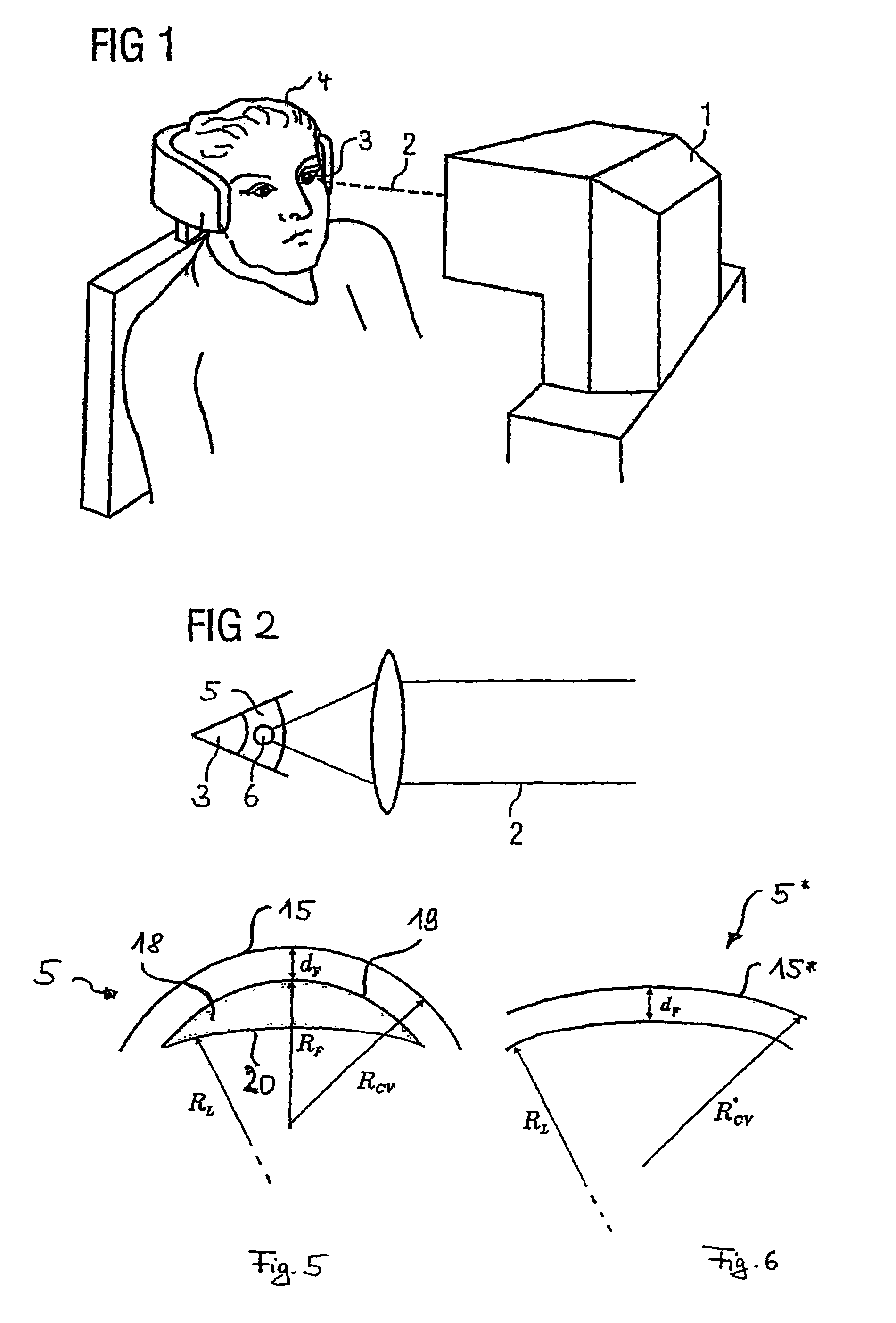 Treatment device for surgically correcting ametropia of an eye and method for creating control data therefore